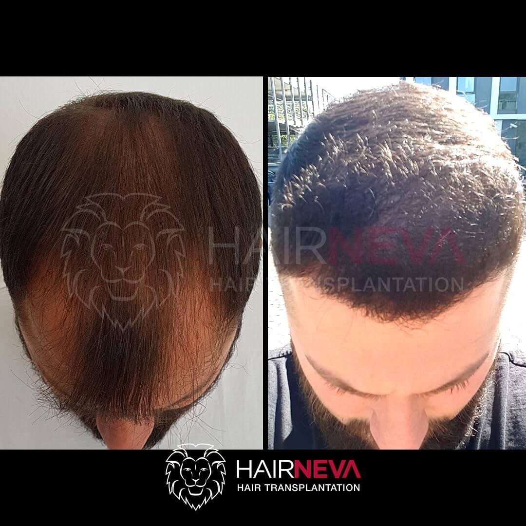 hairneva_106558823_120957936332543_3609893518880146727_n (1)