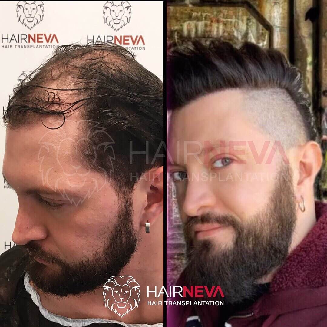 hairneva_109779845_171010834403427_5582747425268737779_n